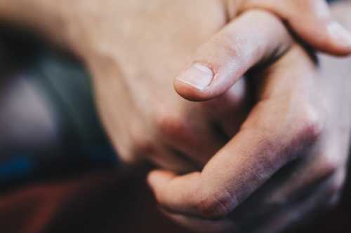 Про що свідчить пожовтіння нігтів — 7 причин, які пов’язані зі здоров’ям та з зовнішніми факторами