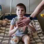11-річний хлопчик, який втратив ногу внаслідок авіаудару Харківщиною, отримав протез