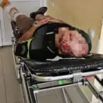Аби незаконно потрапити до Польщі, чоловік зістрибнув з потяга та зламав ногу і розбив голову